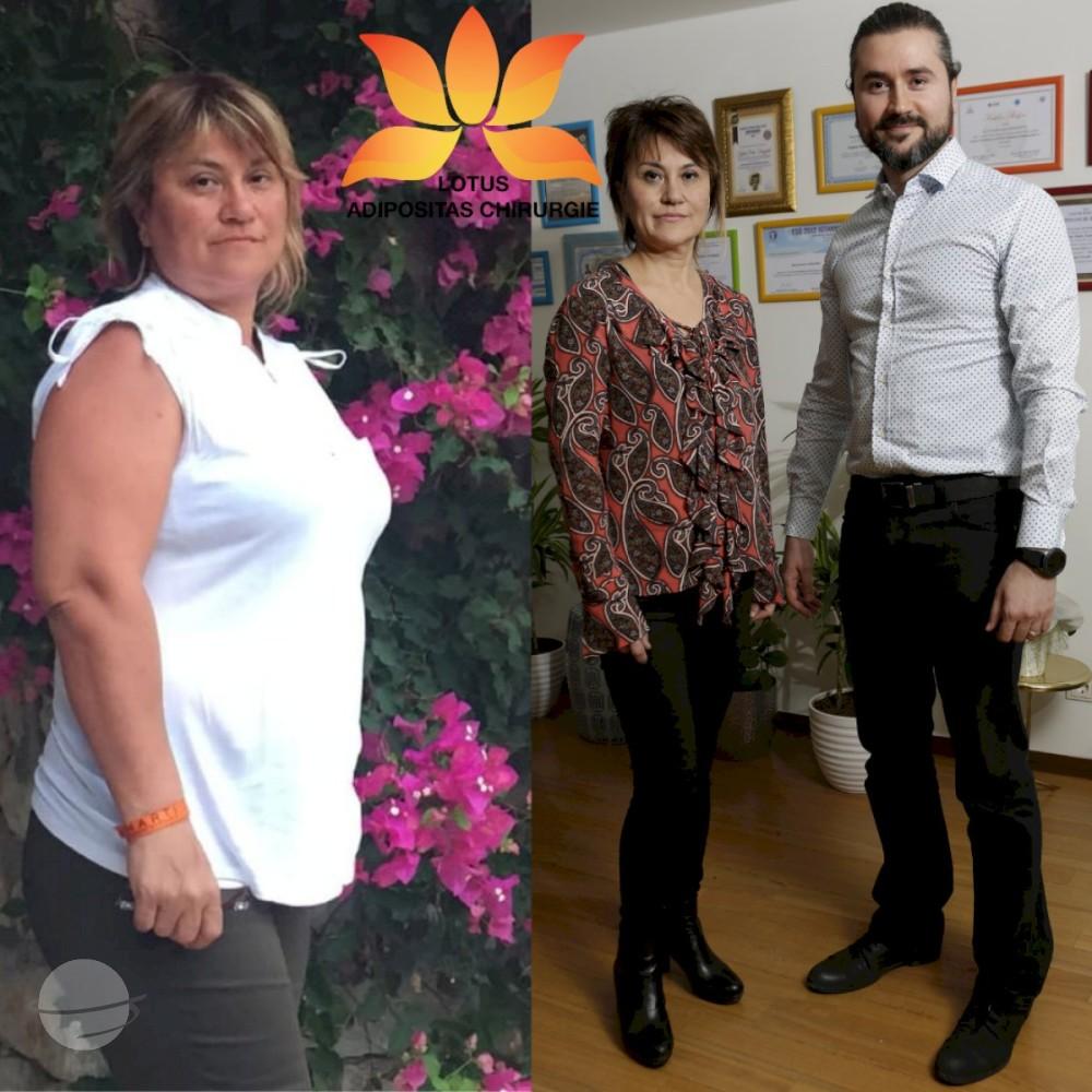 Istanbul weight loss