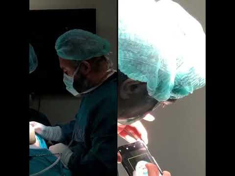 Rhinoplasty