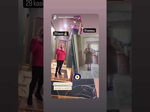 Sleeve Gastrectomy