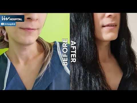 MTF & FTM Cambiamento della voce - Tiroplastica