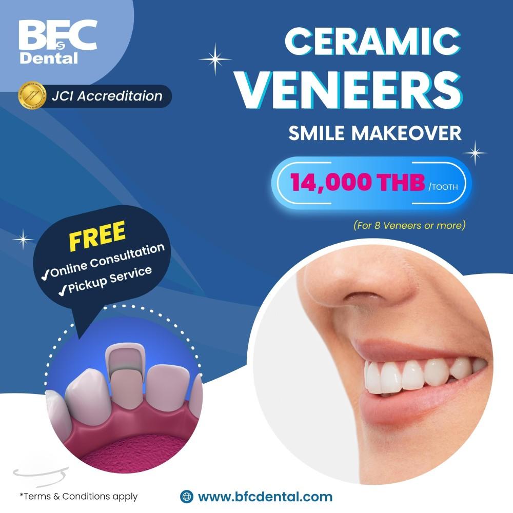 Veneers Promotion (1)