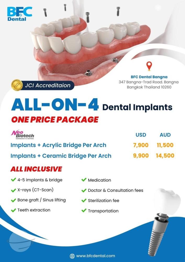 ALL ON 4 promotion BFC Dental 