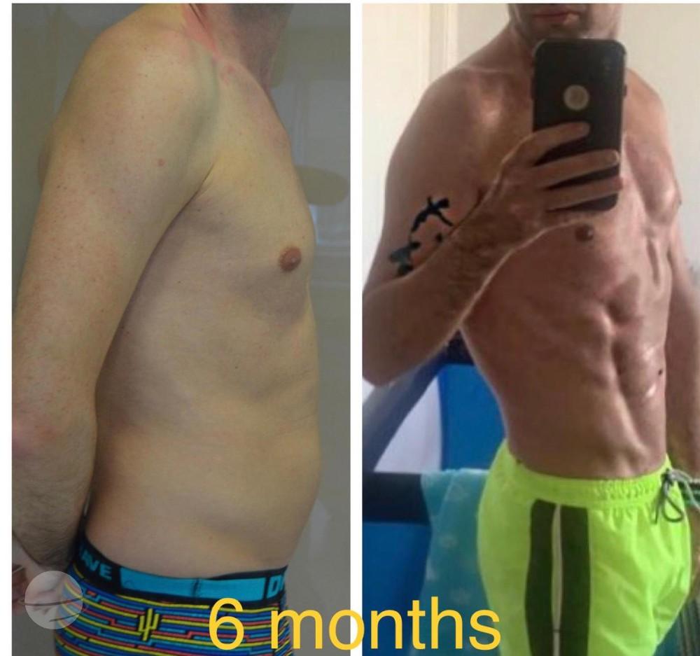 Liposixpack