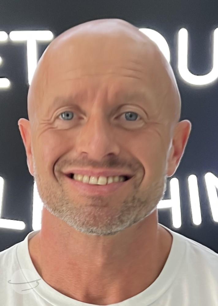 Resultado de antes y después para Coronas de circonita — Dentglow