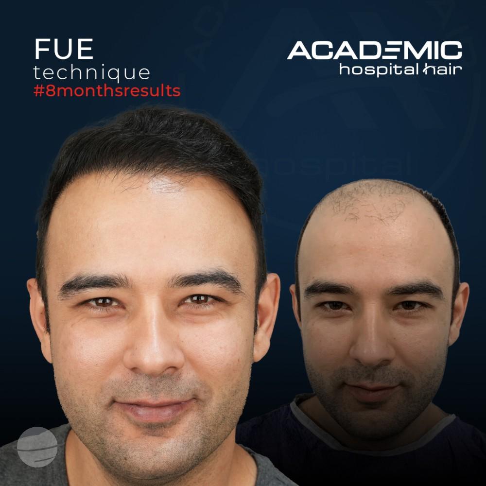 Mustafa Ugur_B-A_KOYU