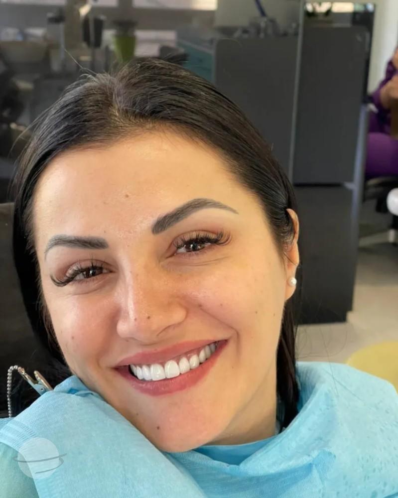 Resultado de antes y después para Coronas dentales — Dental Med Austria
