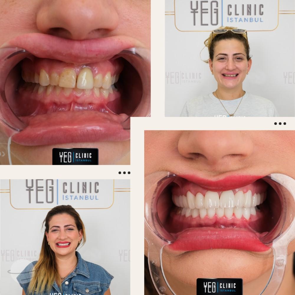 Yeg clinic dental istanbul 