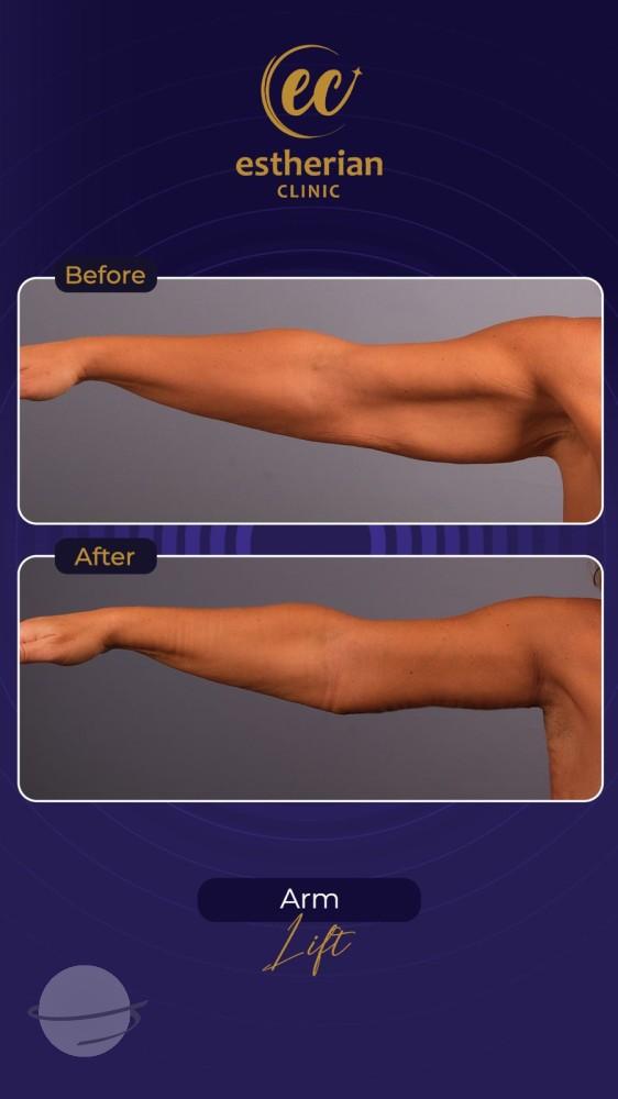 Estherian Istanbul on Esthetic Planet