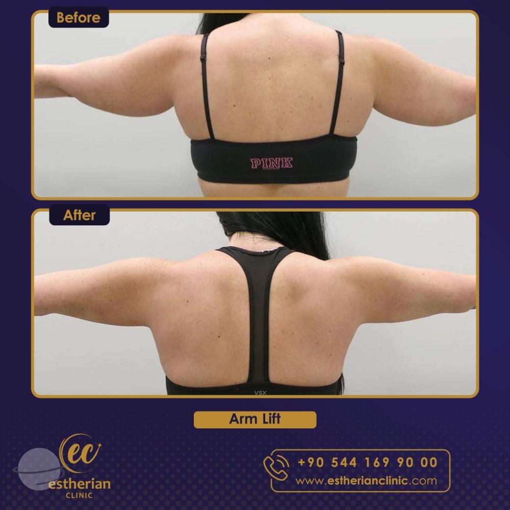 Estherian Istanbul on Esthetic Planet