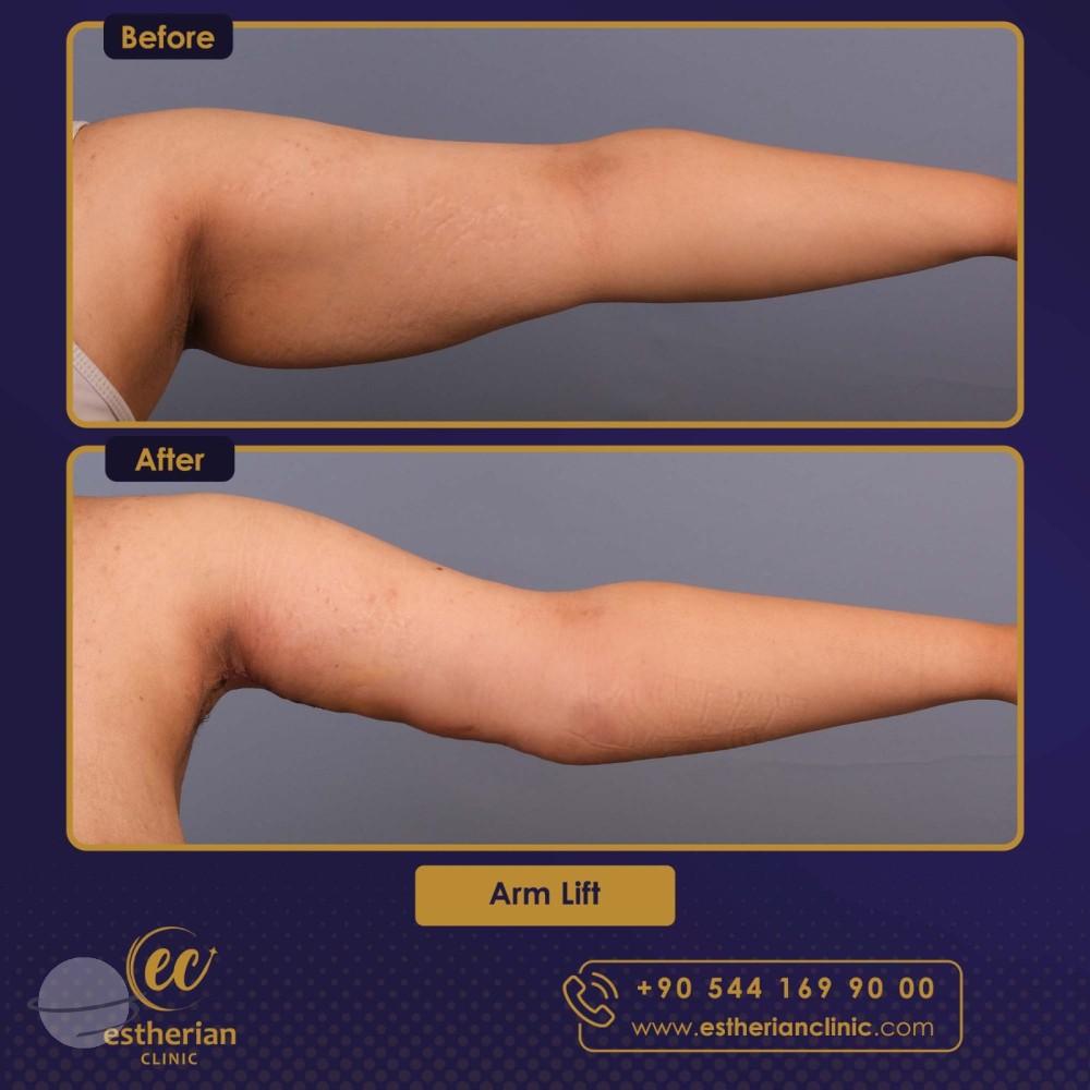 Estherian Istanbul on Esthetic Planet