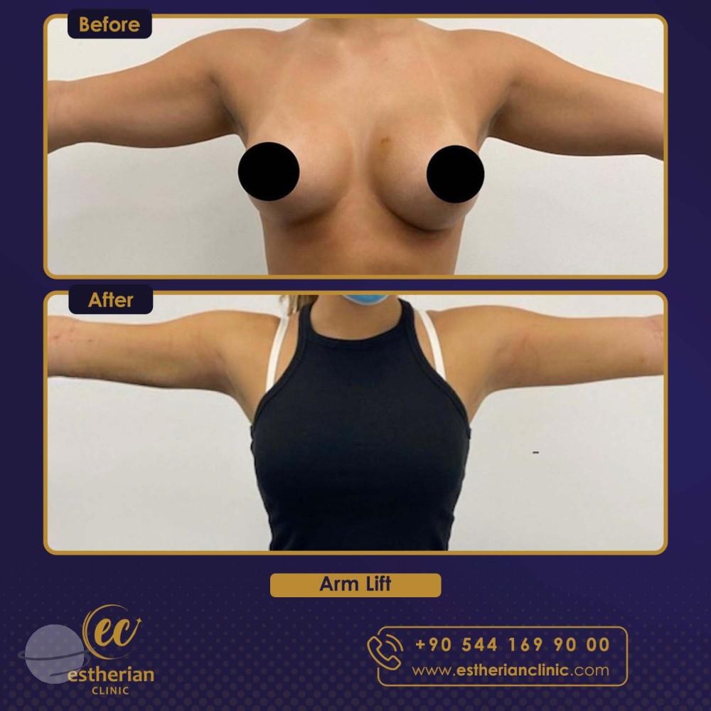 Estherian Istanbul on Esthetic Planet