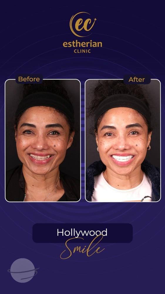 Estherian Istanbul on Esthetic Planet