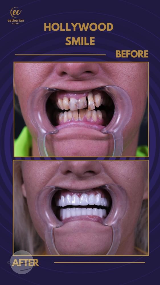 Estherian Istanbul on Esthetic Planet