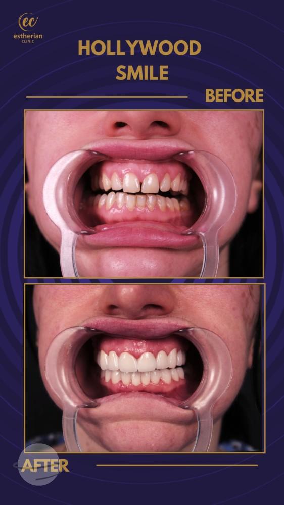 Estherian Istanbul on Esthetic Planet