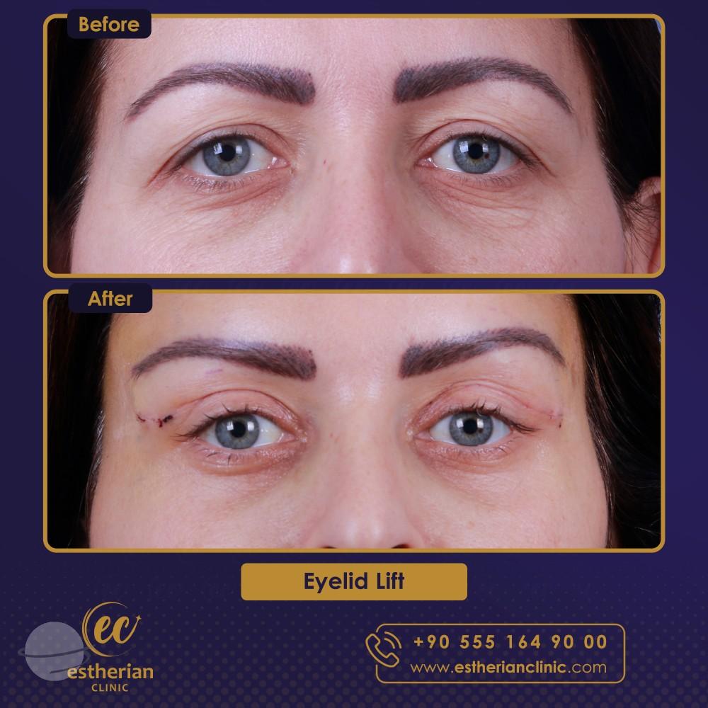 Estherian Istanbul on Esthetic Planet