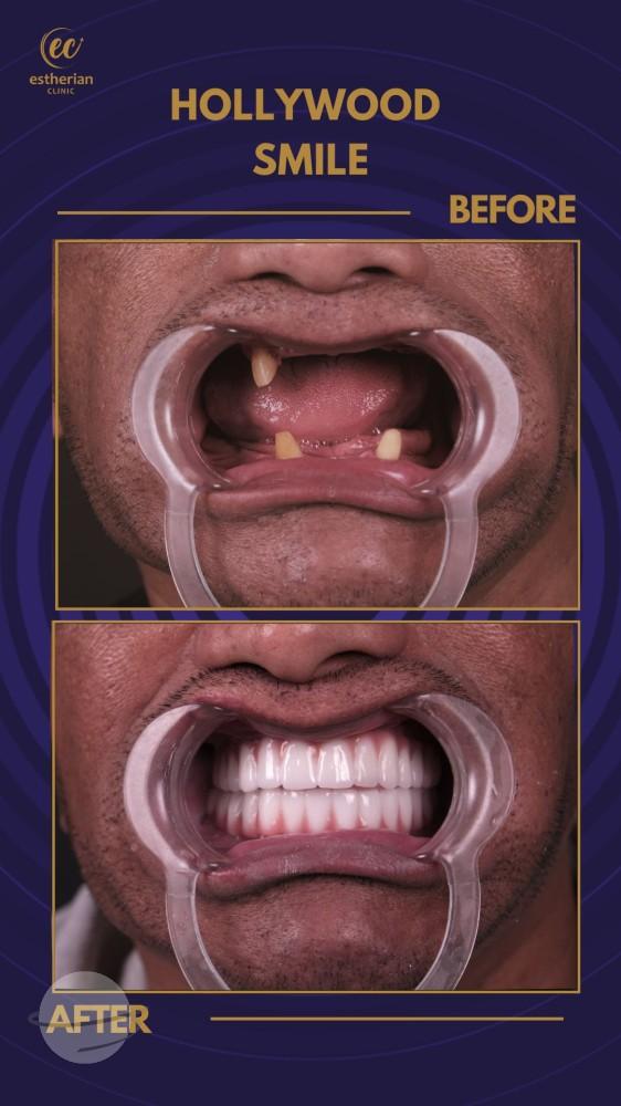 Estherian Istanbul on Esthetic Planet