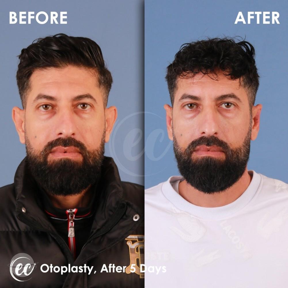 Estherian Istanbul on Esthetic Planet