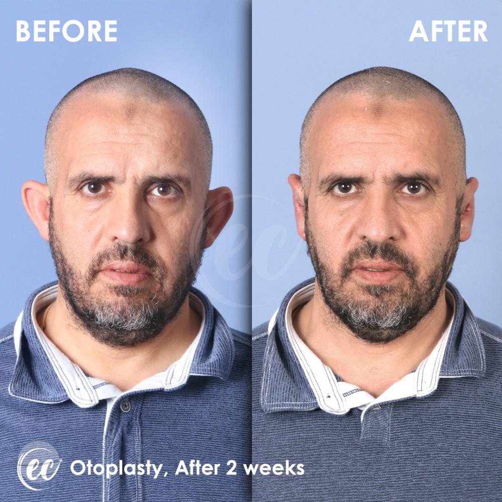 Estherian Istanbul on Esthetic Planet