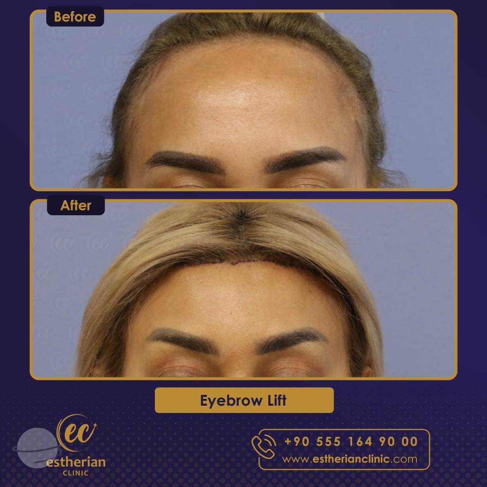 Estherian Istanbul on Esthetic Planet