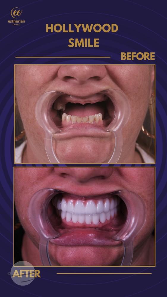 Estherian Istanbul on Esthetic Planet-20241015-WA0053