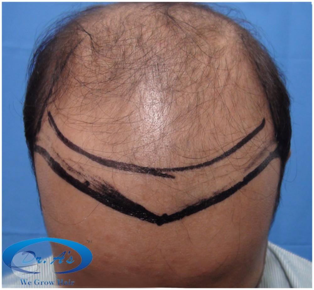 Before picture 508_29