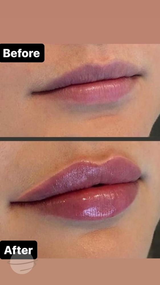 lips