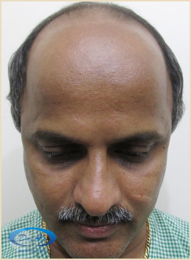 Before picture 242_49