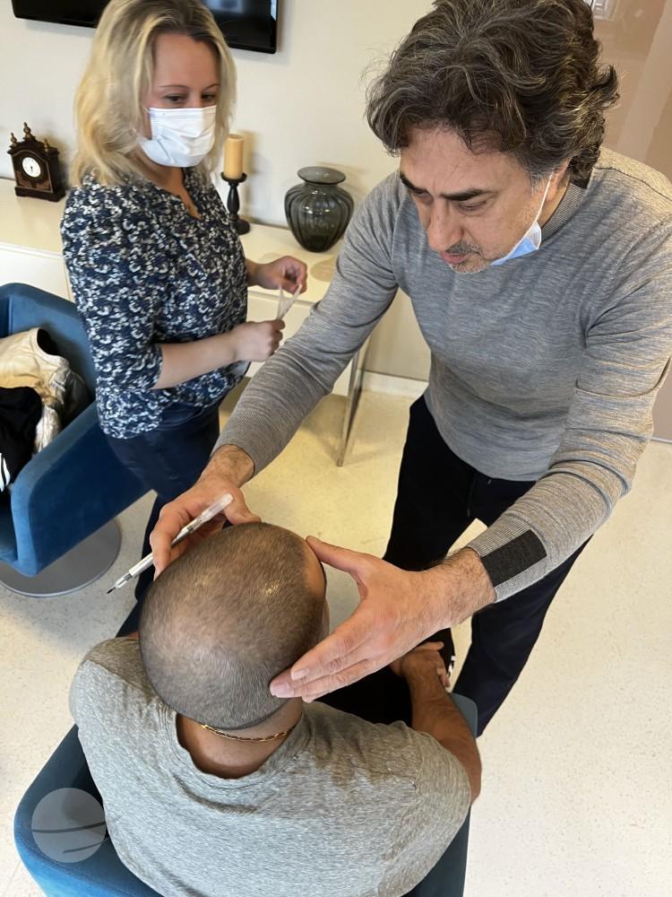 Preop greffe cheveux