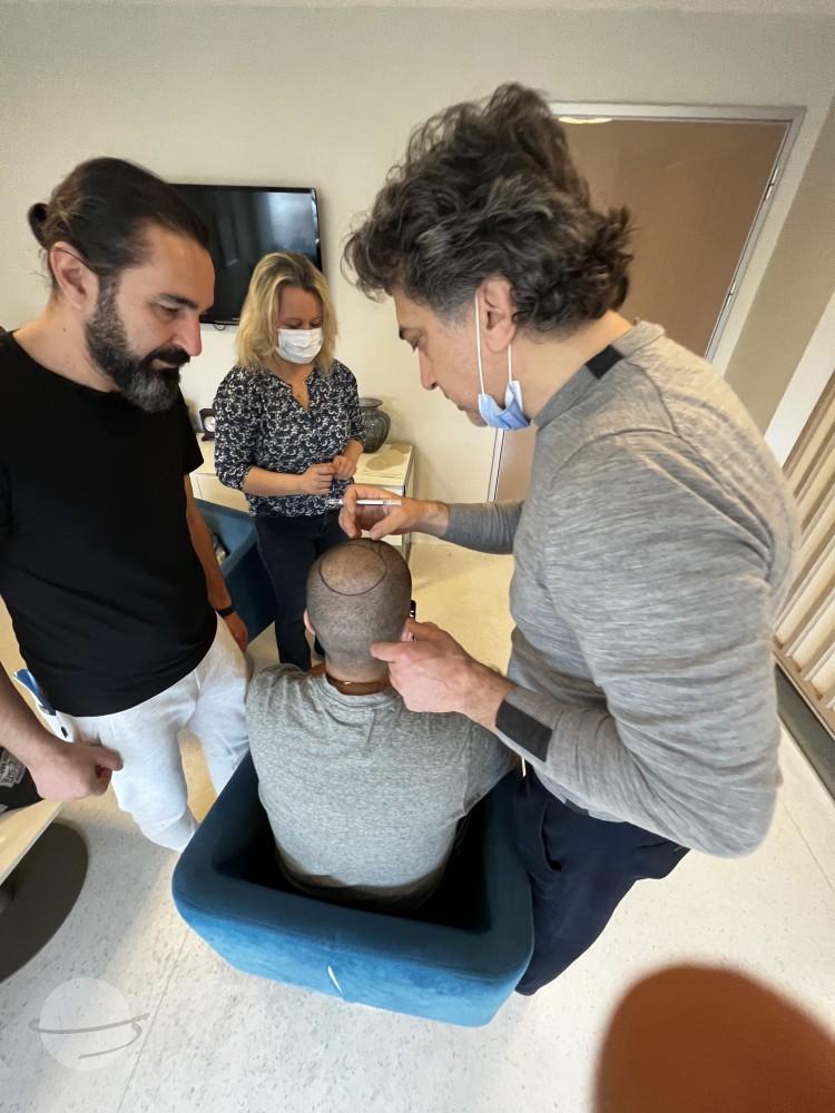 Preop greffe cheveux