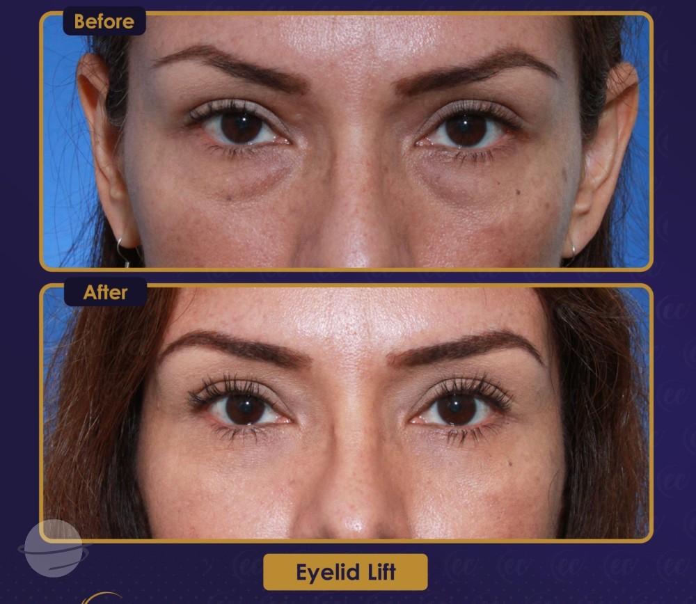 Résultat Estherian13