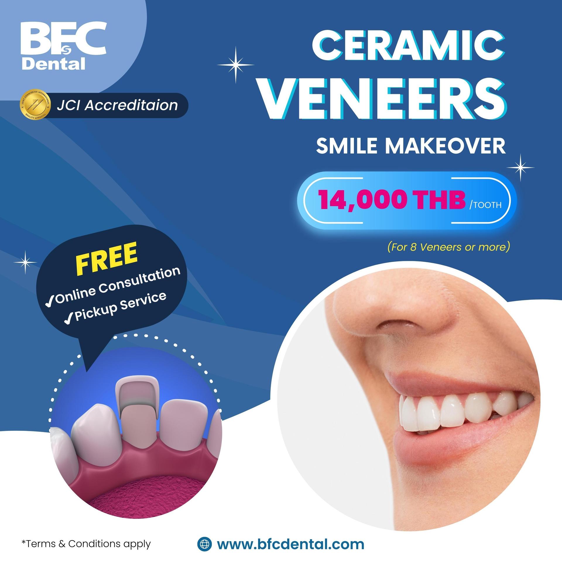 Veneers Promotion (1)