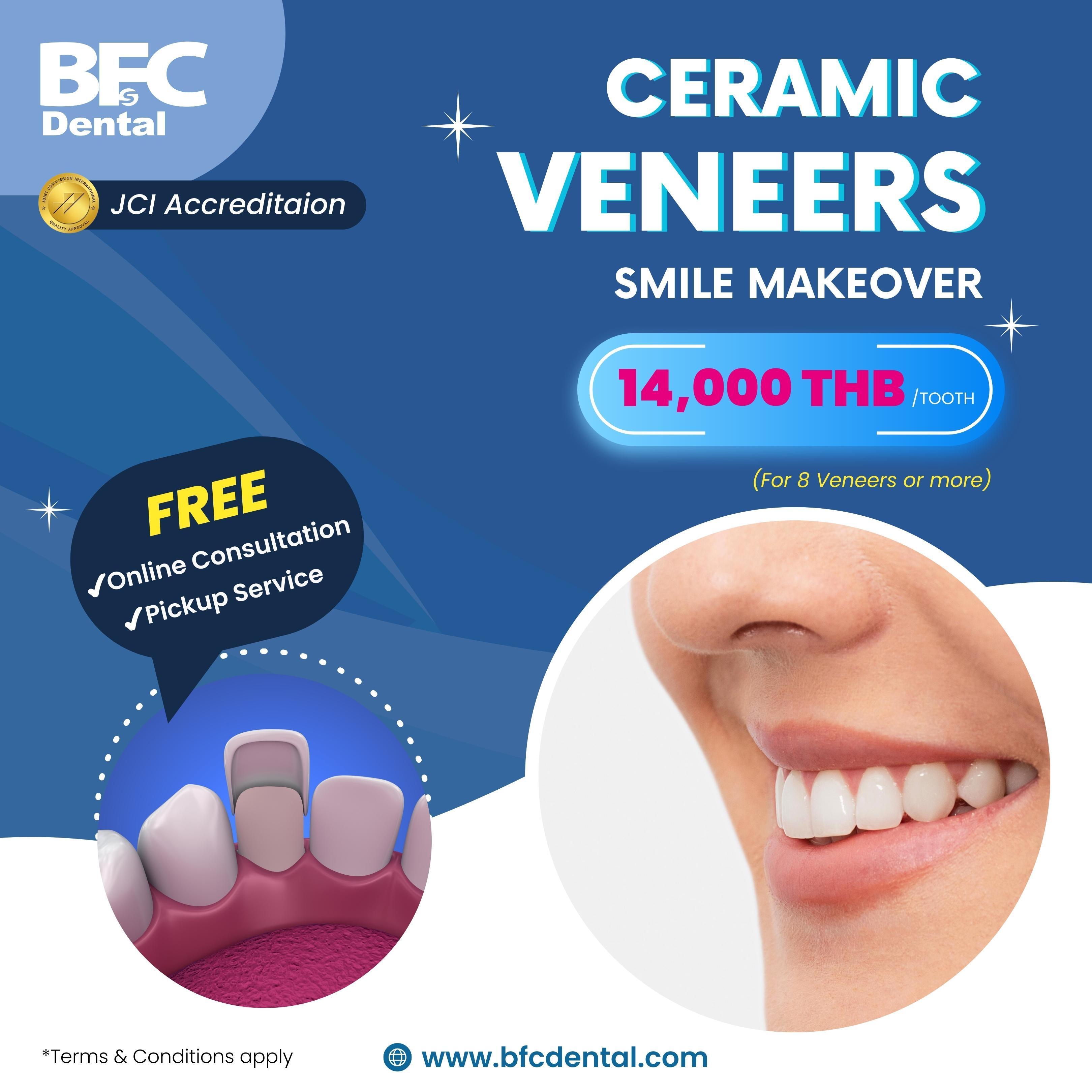 Veneers Promotion (1)