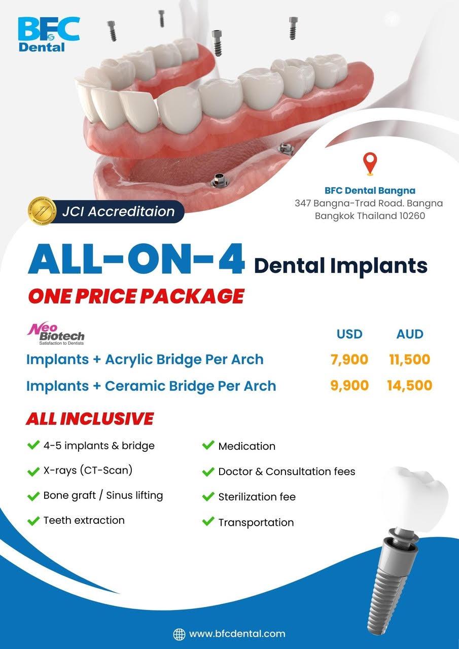 ALL ON 4 promotion BFC Dental 