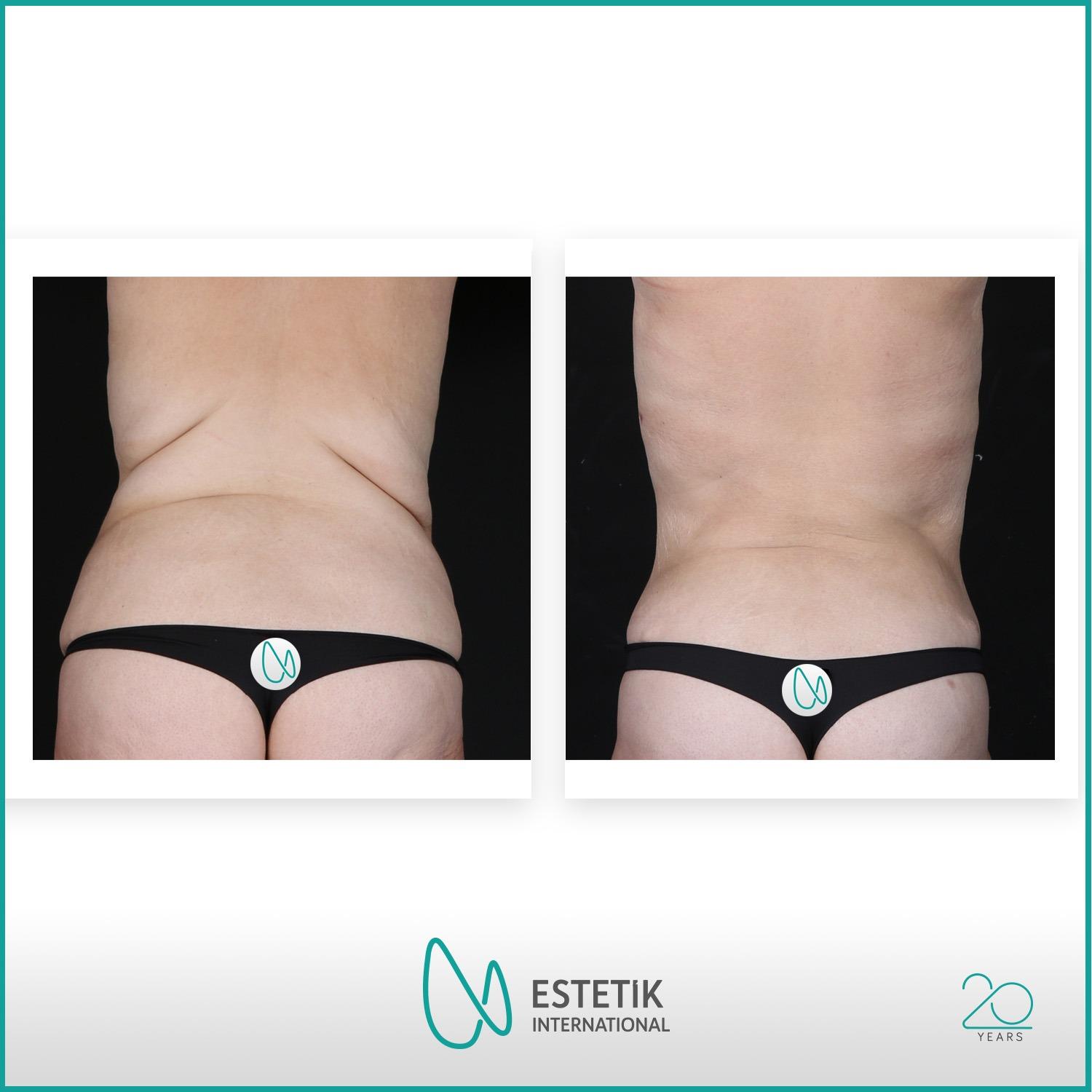 Estetik international results28