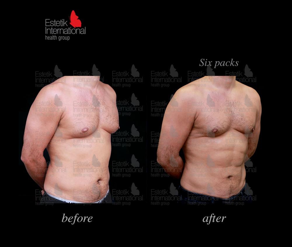 Estetik international results64