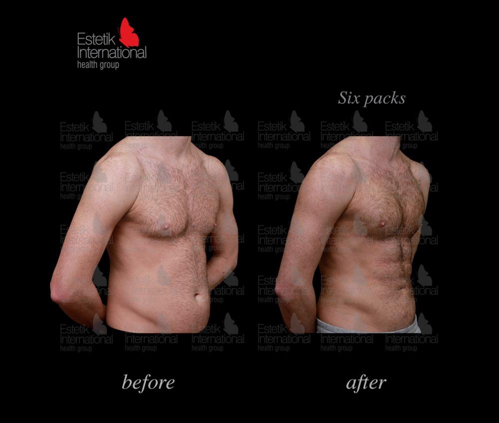 Estetik international results61