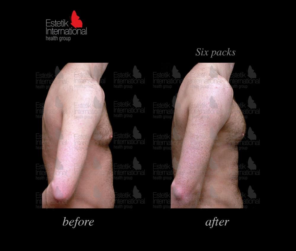 Estetik international results65