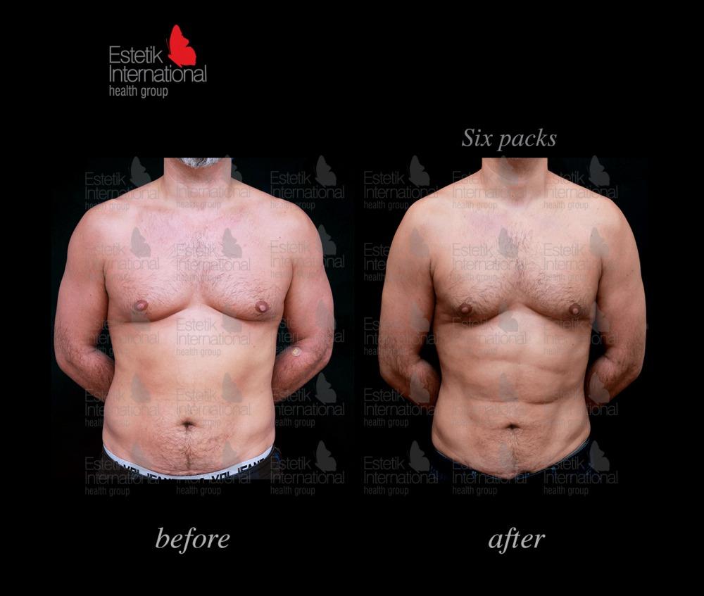 Estetik international results63