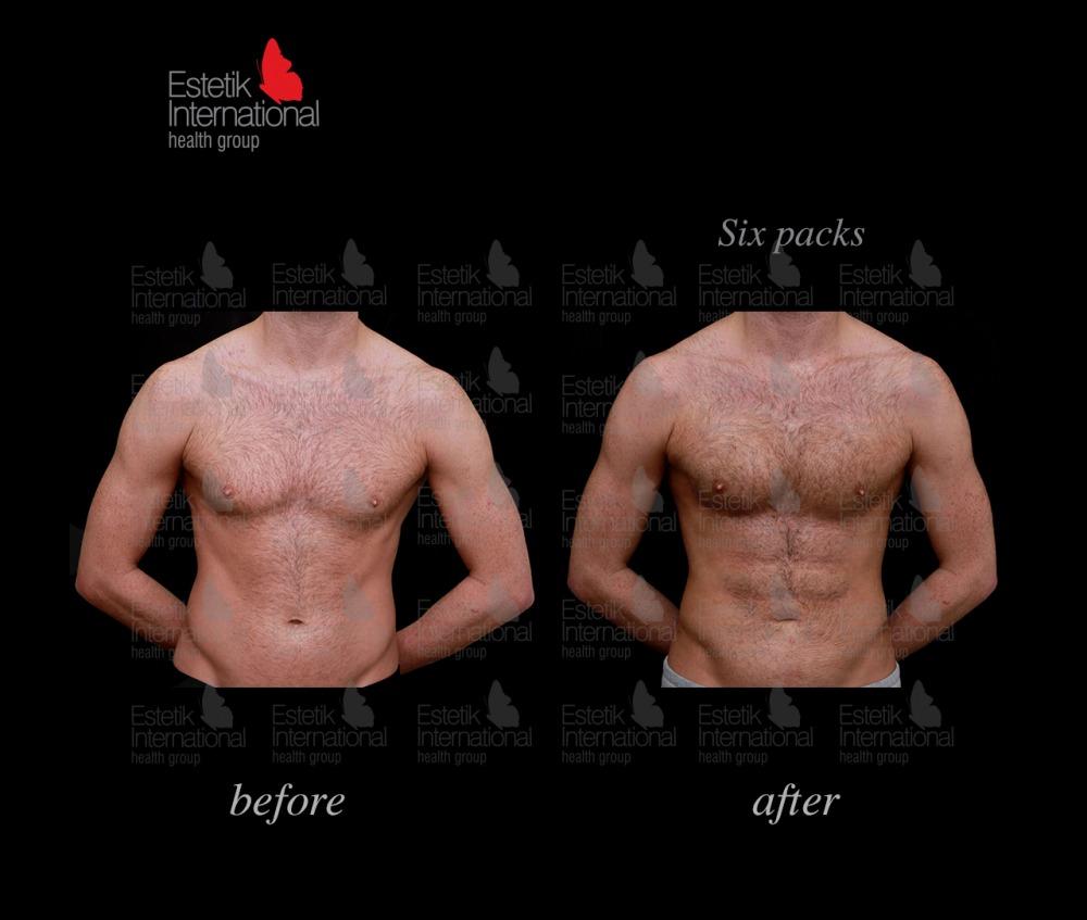 Estetik international results62