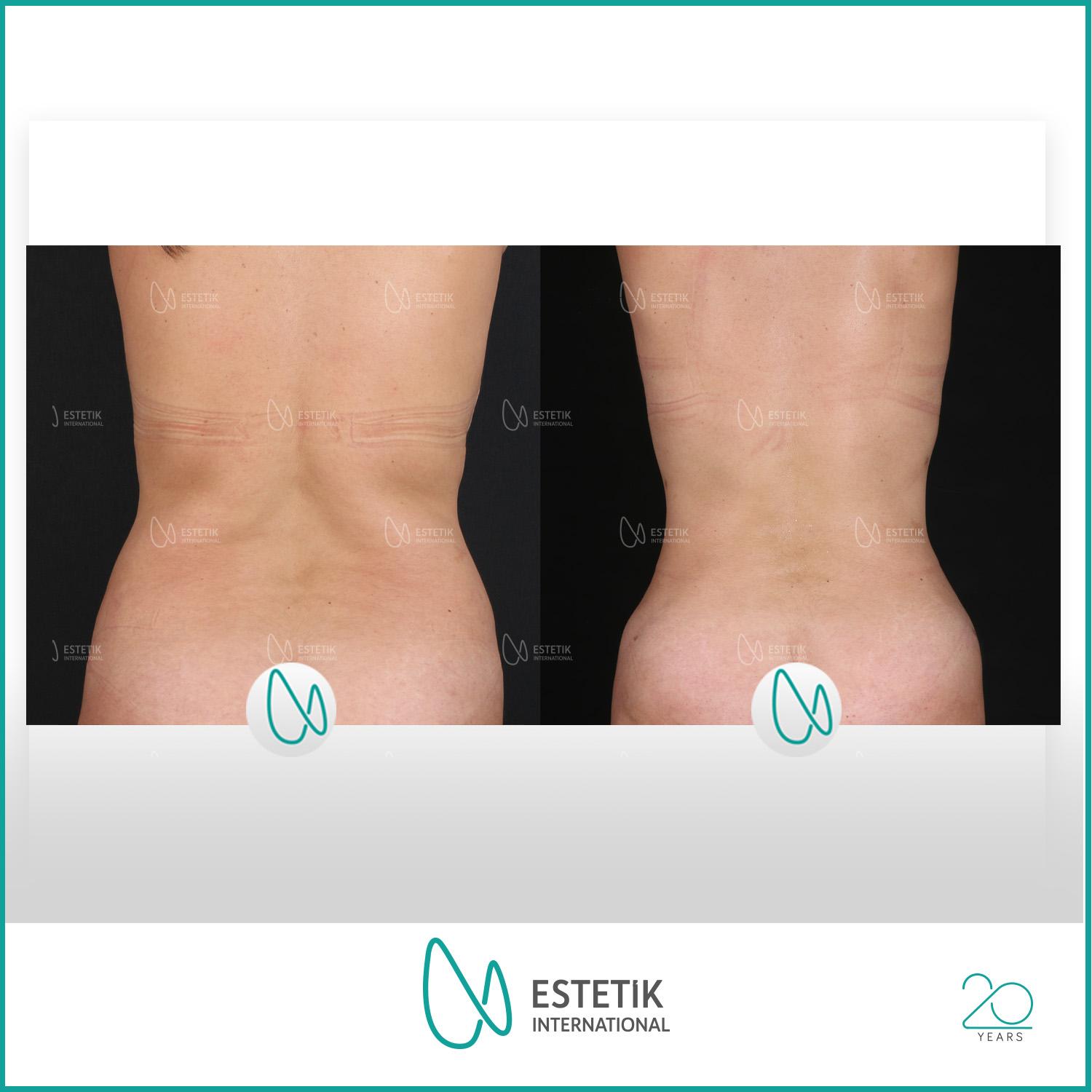 Estetik international results6