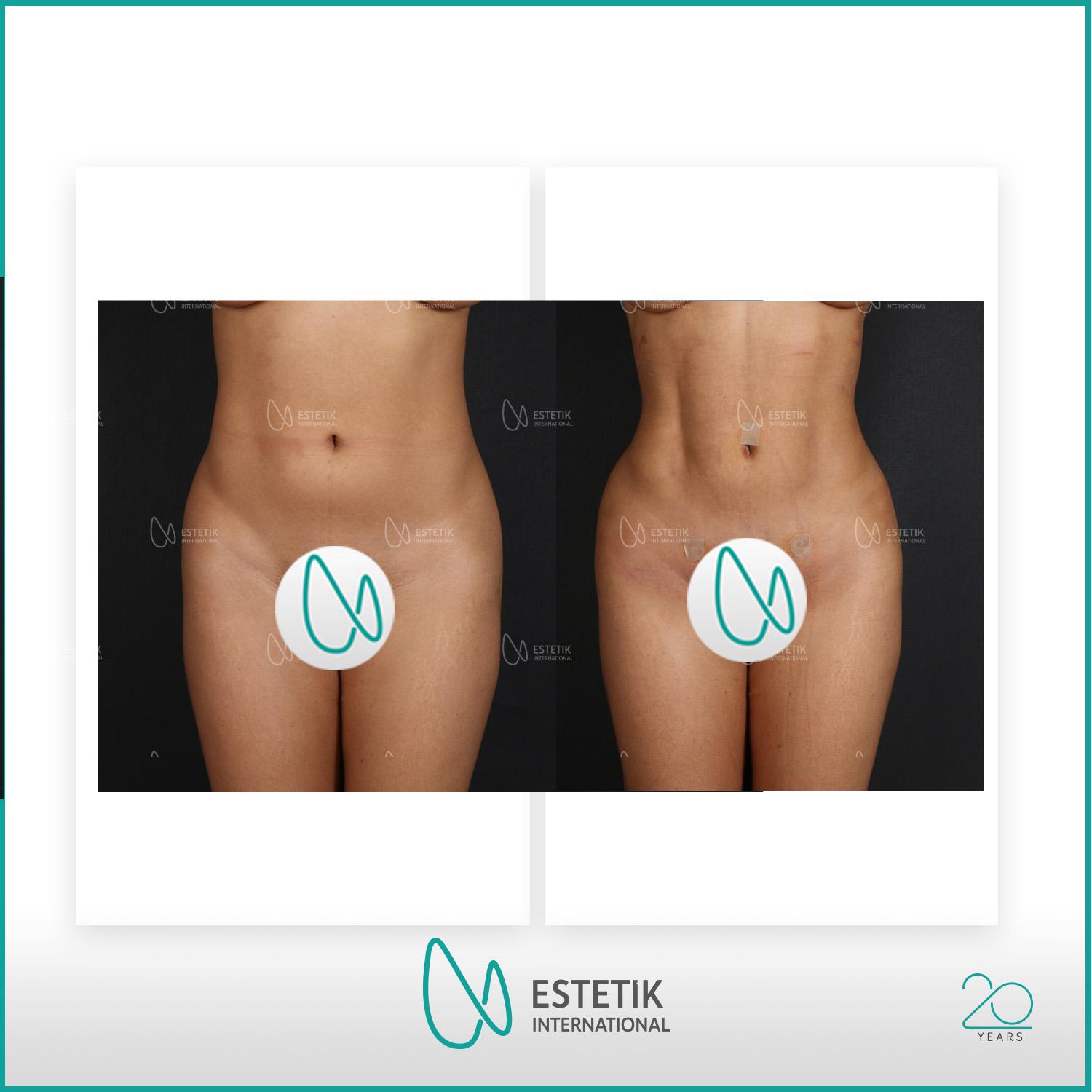 Estetik international results14