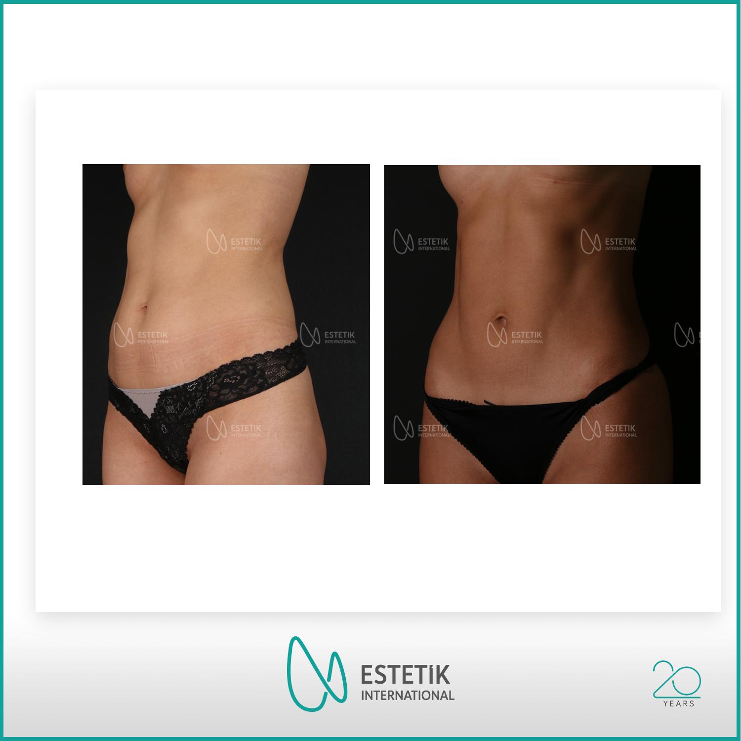 Estetik international results17