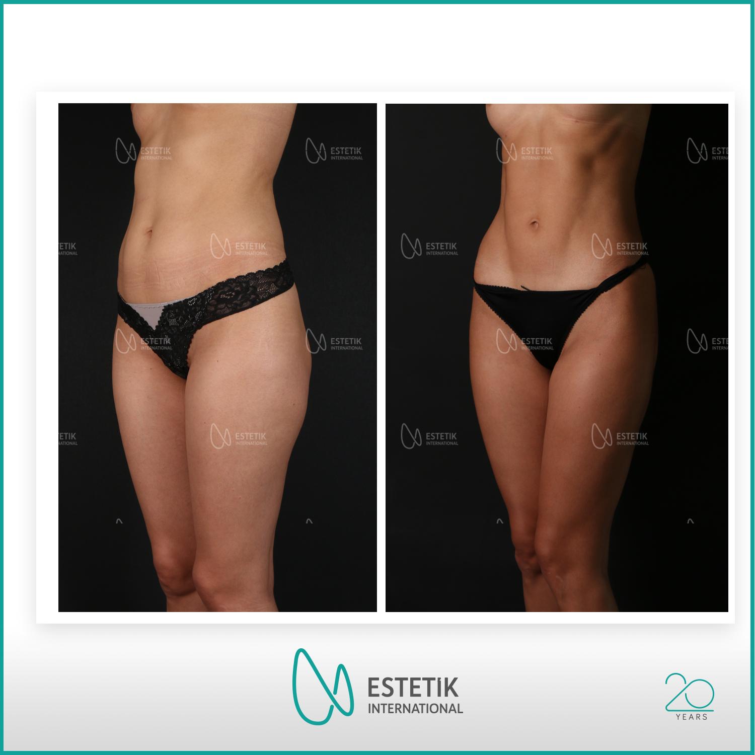 Estetik international results18