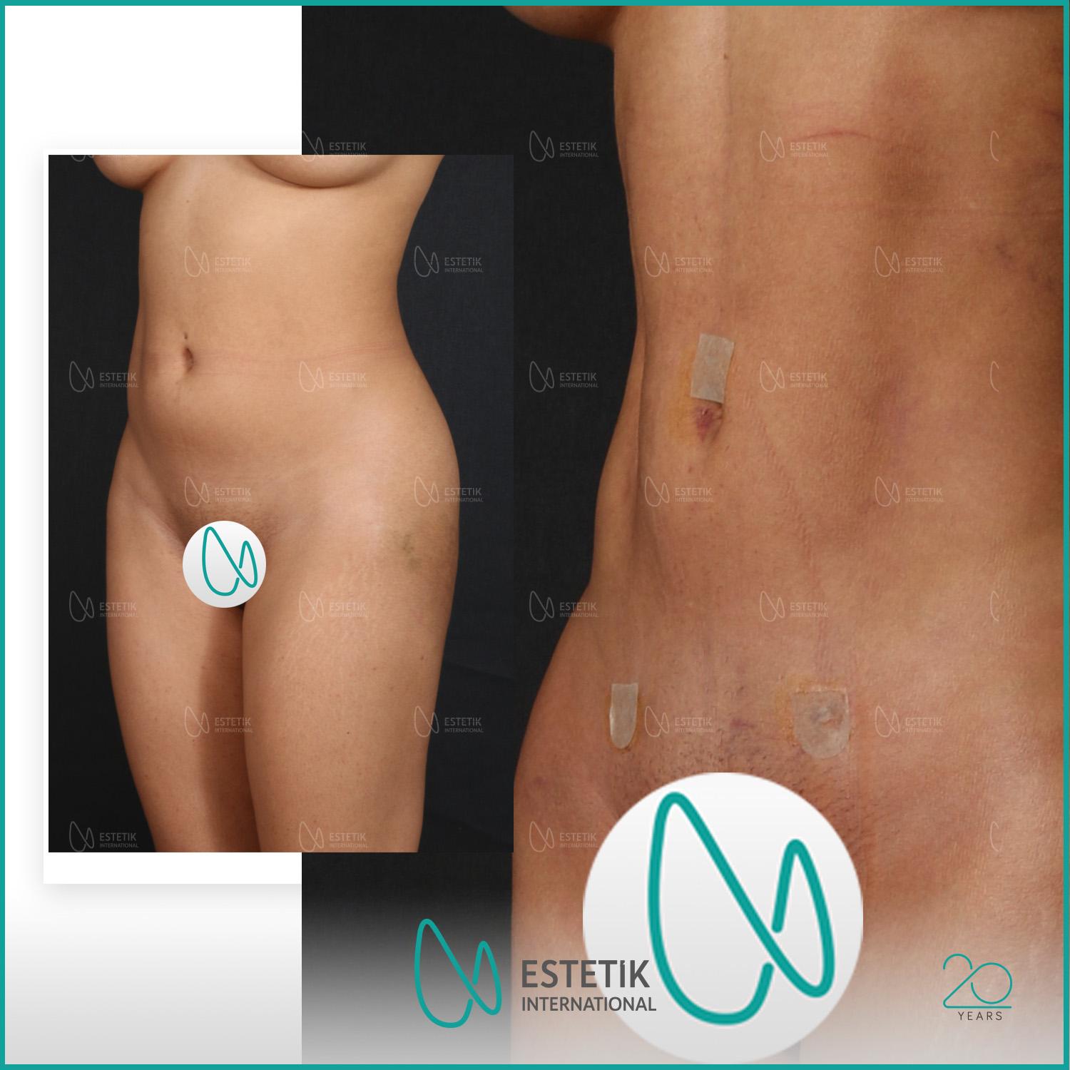 Estetik international results19