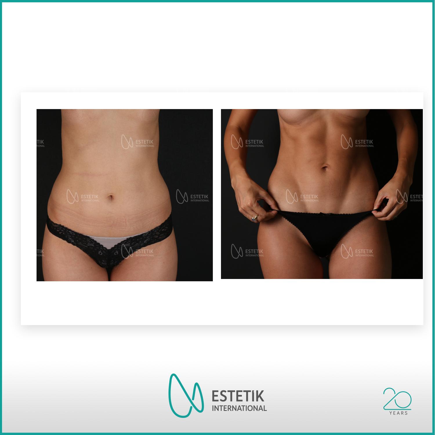 Estetik international results20