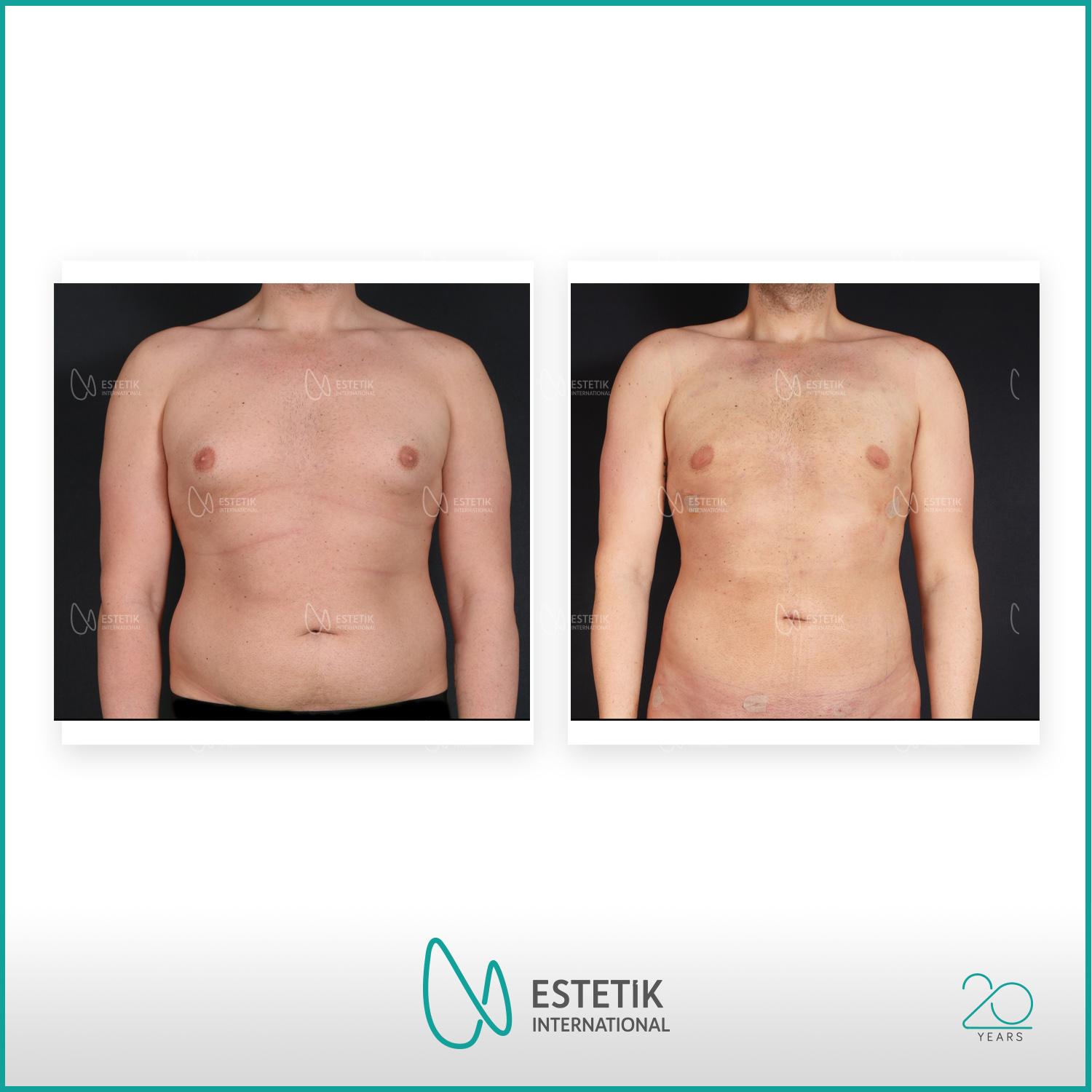 Estetik international results22