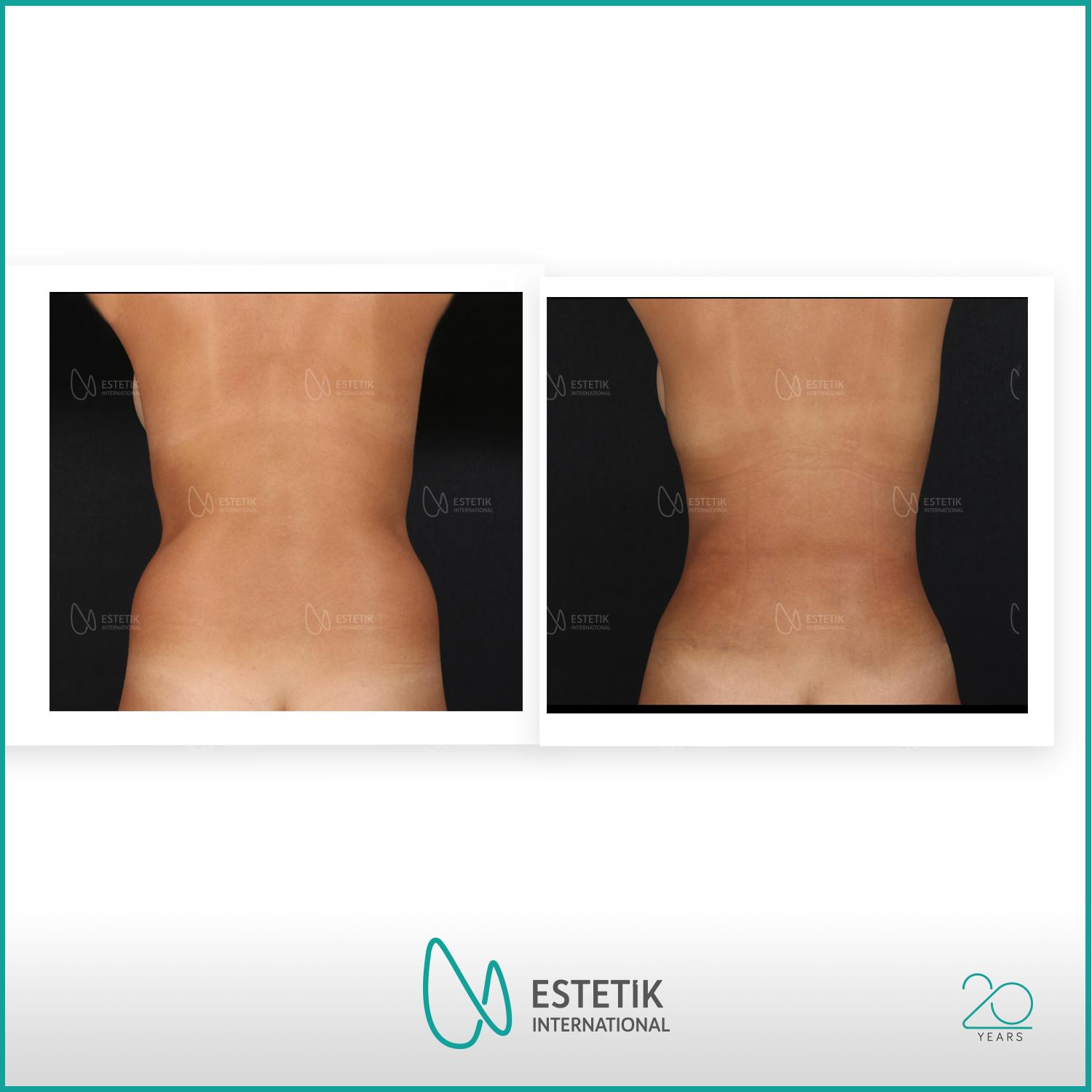 Estetik international results23