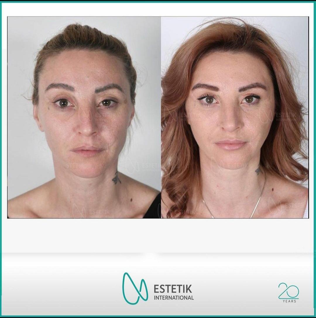 Estetik international results69