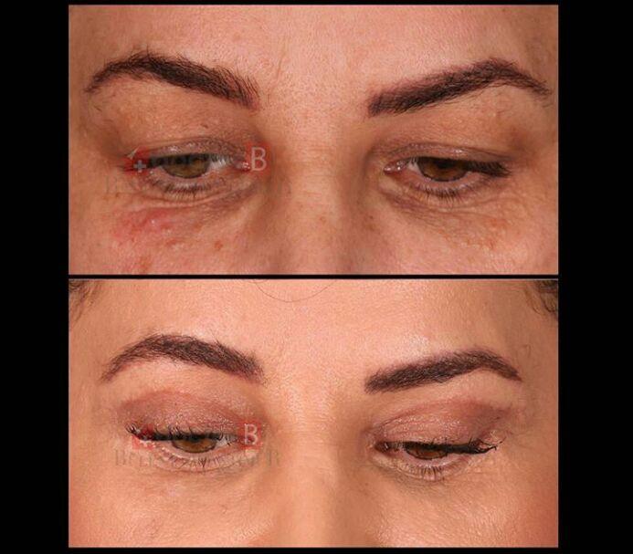 Estetik international results72