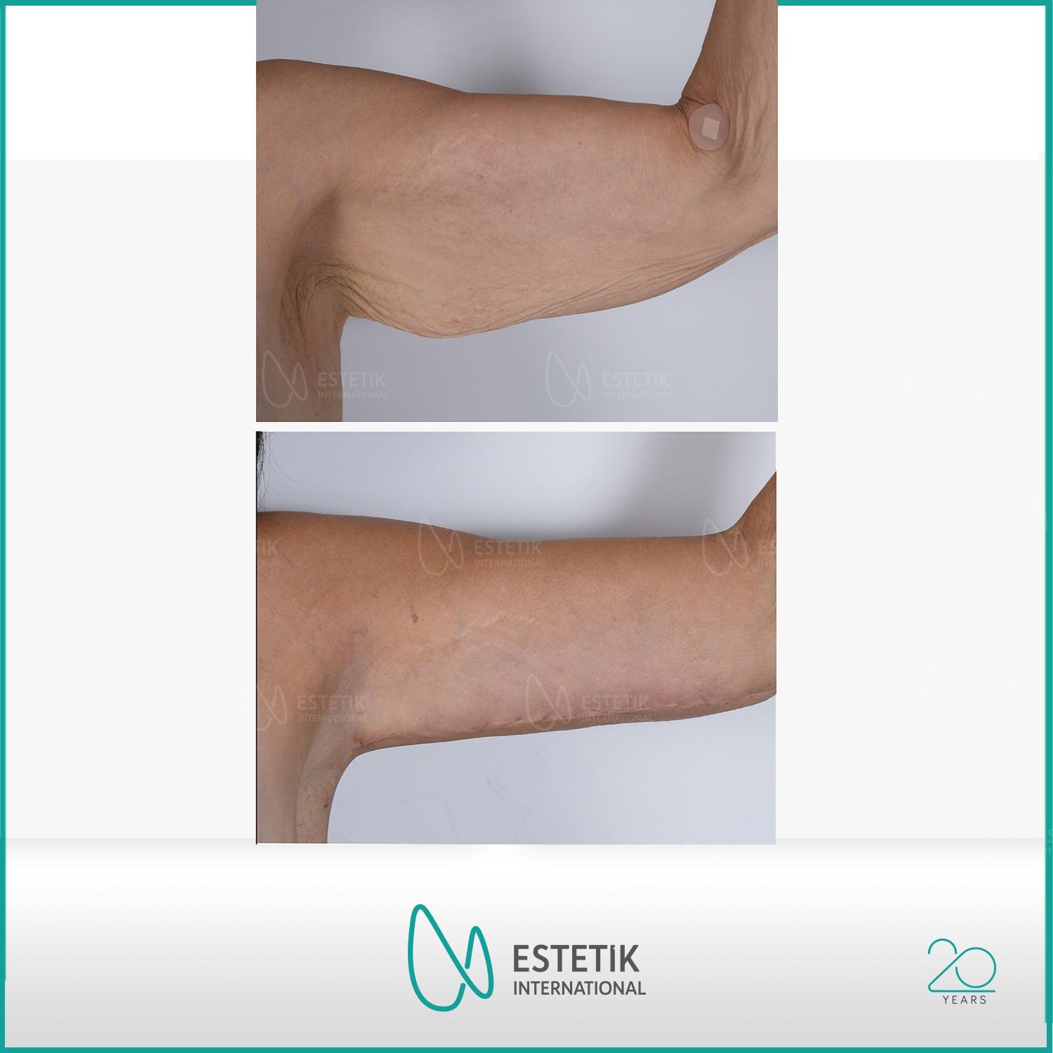 Estetik international results68